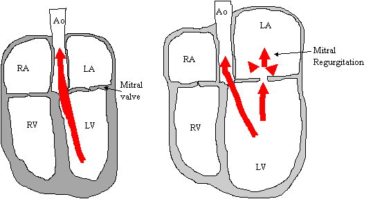Diagram of the heart valves and blood flow